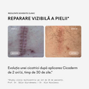 Studiu in vivo pe 24 de pacienți pentru Ivatherm Cicaderm Cremă Reparatoare
